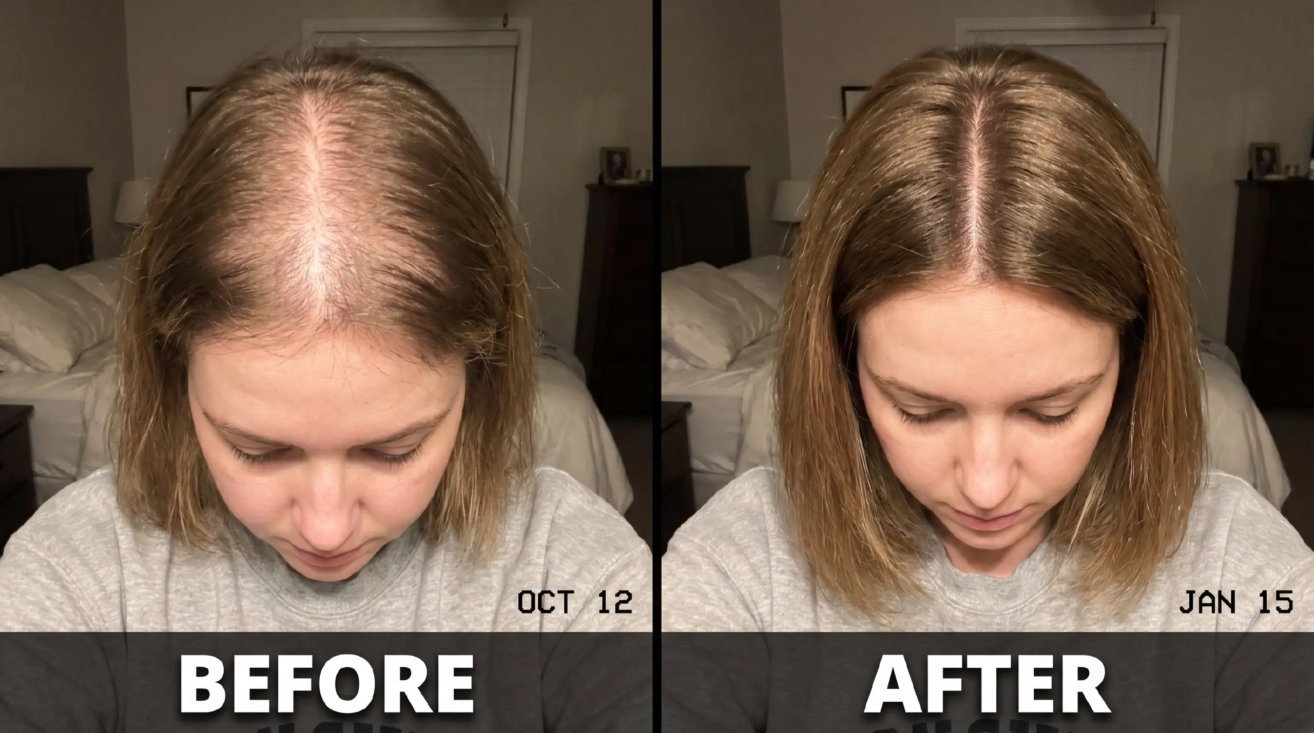 Before and after hair results