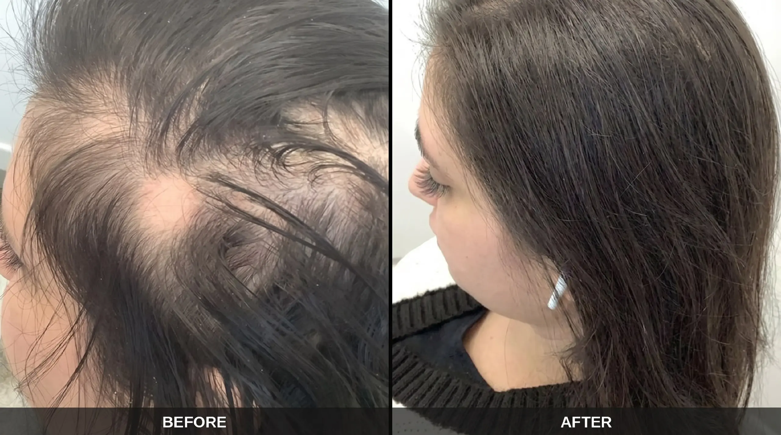 Before and after hair results