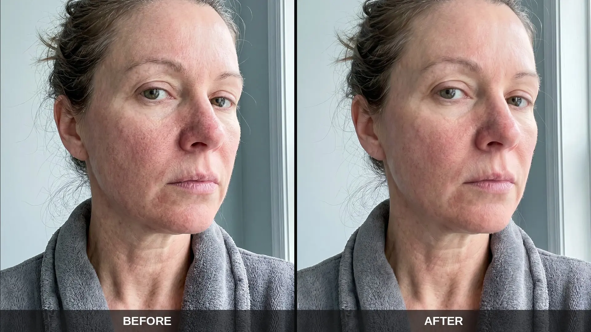 Before and after skin results